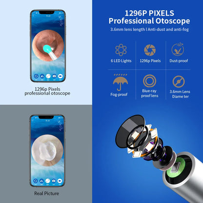 Nuwelo NE3 Ear Wax Removal Kit